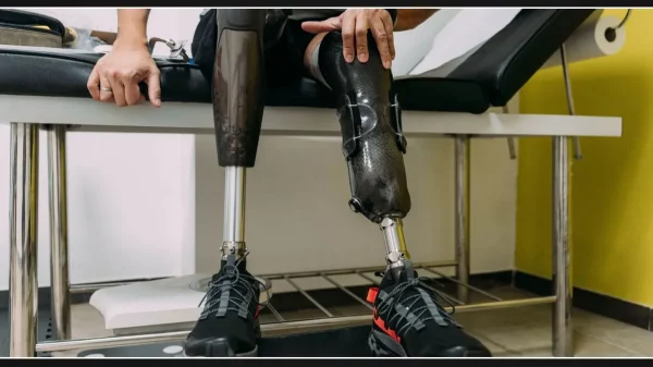 Health insurers place restrictions on coverage for prosthetic limbs, raising doubts about their medical necessity