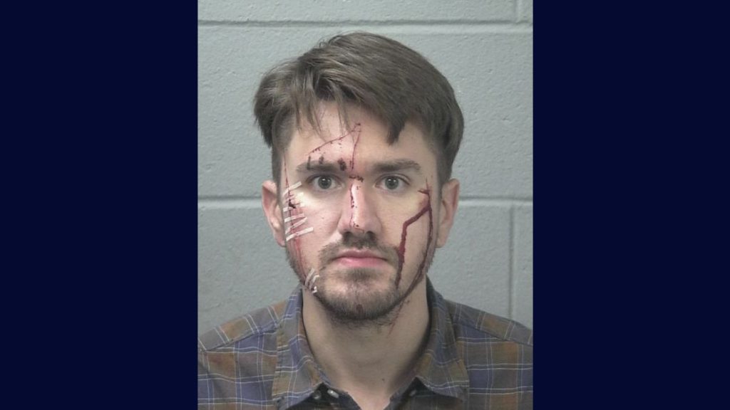 Man cut his own face with a razor so he could blame girlfriend who he assaulted the day before: Police