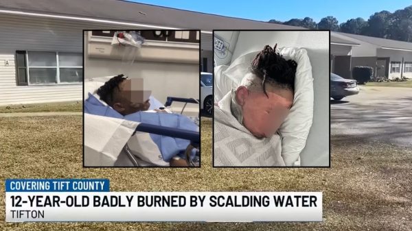 ‘He’s numb about it’: 12-year-old boy’s friends allegedly dump scalding water on him in sleepover prank gone wrong